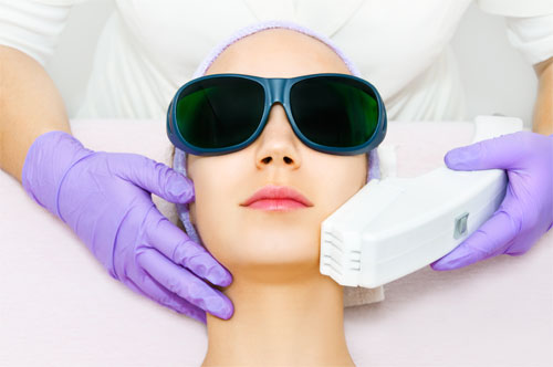 APL hair removal for the chin