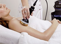 Cavitation-lipo in Norwich